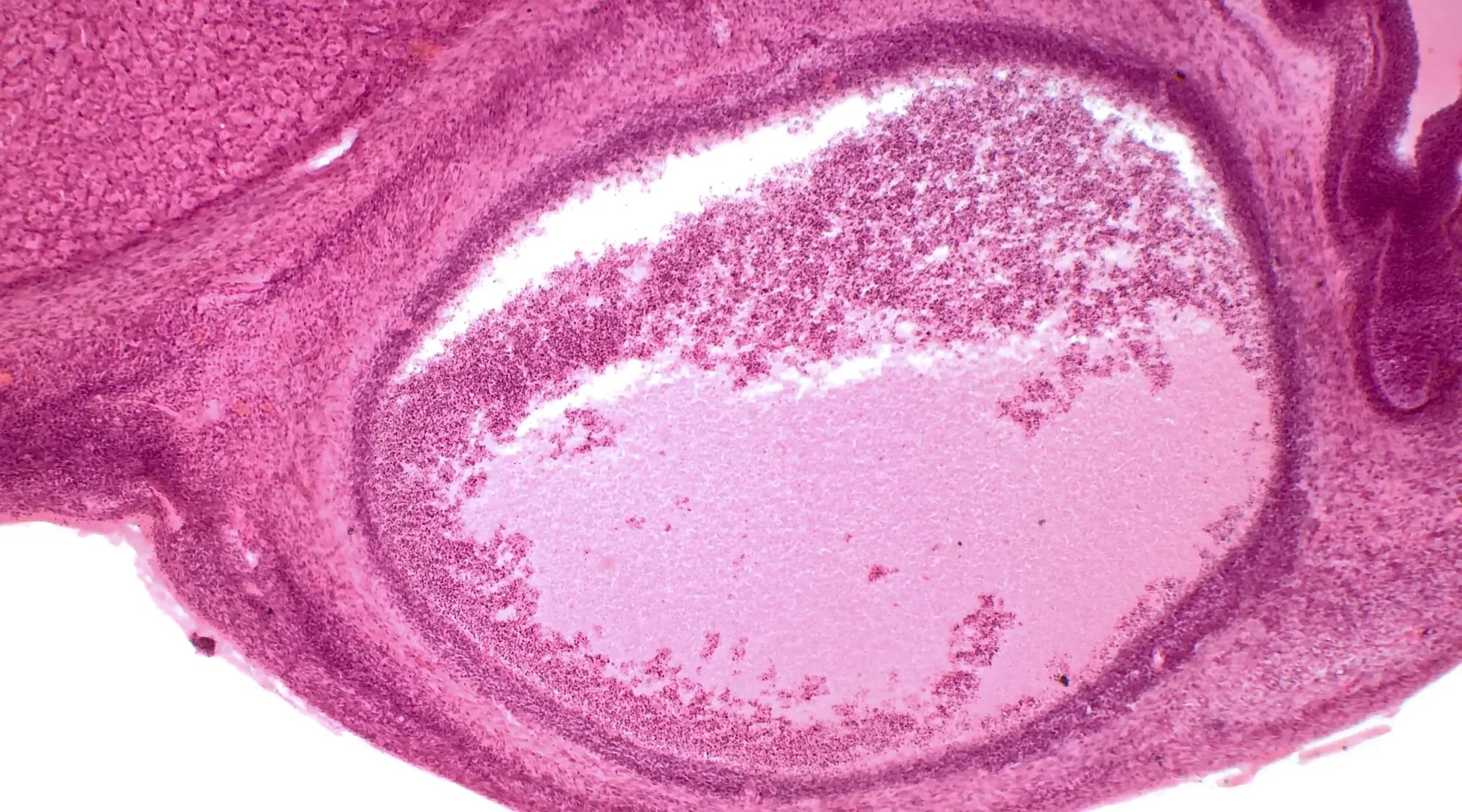 Microscopic image of human ovarian follicle tissue stained in pink and purple, showing cellular structure and development.