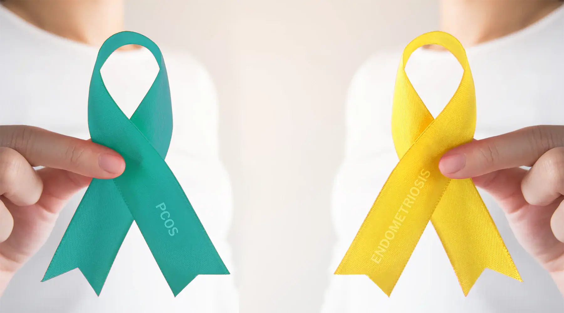 PCOS vs. Endometriosis: What are the Differences?