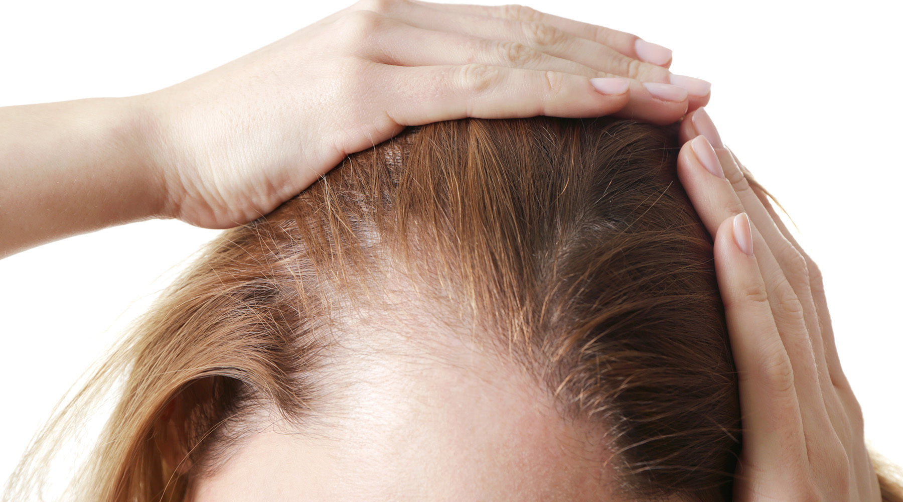 Sudden Postpartum Hair Loss: What Causes it?