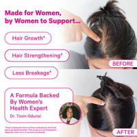 Postpartum Hair Loss Gummies