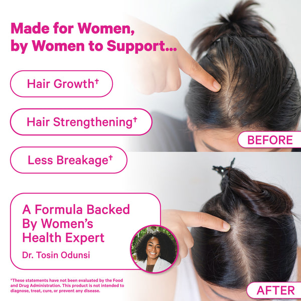 Postpartum Hair Loss Gummies